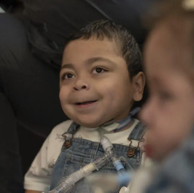Closeup of child with special breathing apparatus.